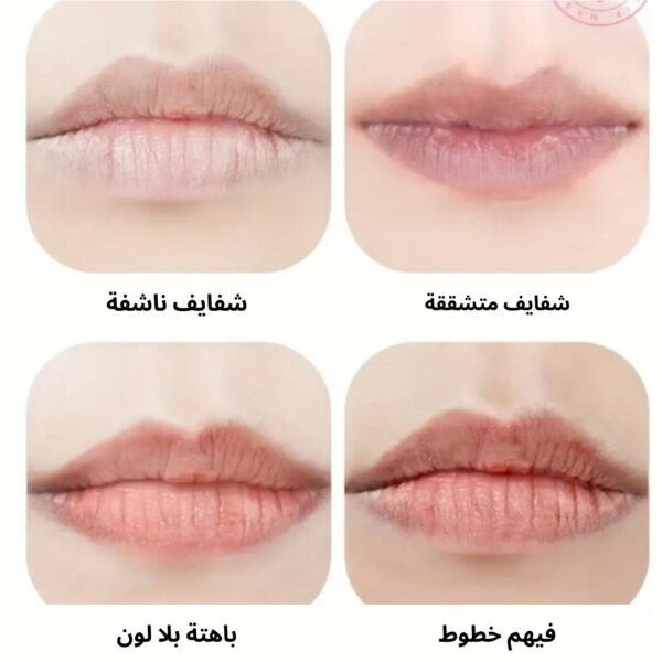 Hydrating Collagen Lip Mask – Single / Pack of 5 – Image 4
